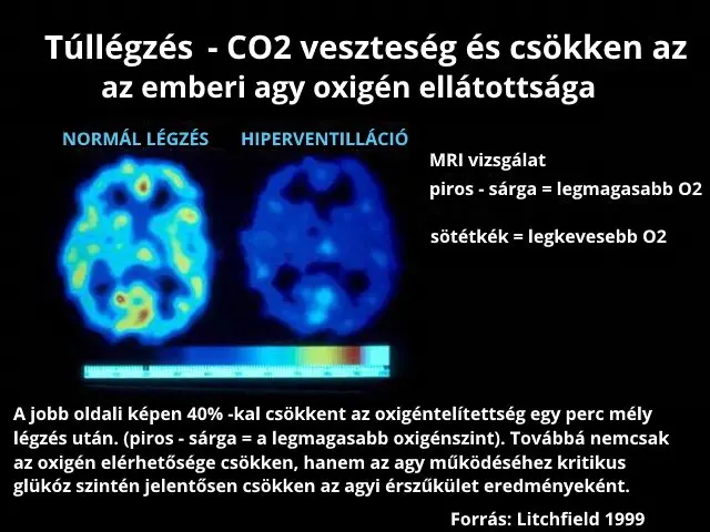 Miért fontos az orrlégzés? Túllégzés hatása az agy oxigén szintjére.