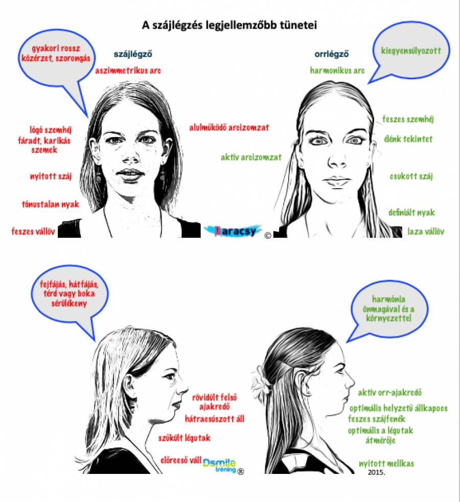 Táplálkozás, horkolás, kusza fogazat – Avagy mit okoz a gyenge száj-arci (orofaciális) izomzat?